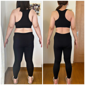 ダイエットビフォーアフター 大分 痩身エステ 産後